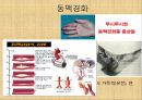 [혈압 치료 방안] 운동 중 혈압의 변화 원인과 문제점 및 다양한 혈압 관련 질환과 치료방안 9페이지