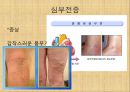 [혈압 치료 방안] 운동 중 혈압의 변화 원인과 문제점 및 다양한 혈압 관련 질환과 치료방안 14페이지