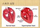 [혈압 치료 방안] 운동 중 혈압의 변화 원인과 문제점 및 다양한 혈압 관련 질환과 치료방안 58페이지