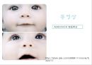 ADHD의 현황과 특징, 증상, 진단, 치료방안 10페이지