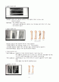 상완골 골절 (폐쇄성골절) Case study 5페이지