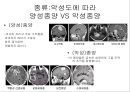 뇌종양종류 및 증상,양성종양 VS 악성종양,뇌종양 수술 방법,뇌종양에 좋은 음식,뇌농양,두부손상,두부손상 응급처치,두부손상에 의한 질환 3페이지