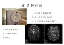 뇌종양종류 및 증상,양성종양 VS 악성종양,뇌종양 수술 방법,뇌종양에 좋은 음식,뇌농양,두부손상,두부손상 응급처치,두부손상에 의한 질환 8페이지