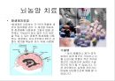 뇌종양종류 및 증상,양성종양 VS 악성종양,뇌종양 수술 방법,뇌종양에 좋은 음식,뇌농양,두부손상,두부손상 응급처치,두부손상에 의한 질환 16페이지
