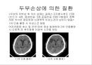 뇌종양종류 및 증상,양성종양 VS 악성종양,뇌종양 수술 방법,뇌종양에 좋은 음식,뇌농양,두부손상,두부손상 응급처치,두부손상에 의한 질환 21페이지