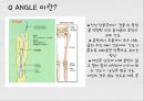 대퇴사두각(q angle)의 증가로 인한 부상의 종류 2페이지