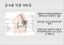 대퇴사두각(q angle)의 증가로 인한 부상의 종류 6페이지