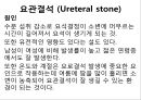 비뇨기계 질환과 간호 (신장 결석, 요관결석, 요로감염, 신장암, 방광염, 방광암, 과민성 방광, 요실금, 방광 결석, 방광요관역류, 전립선 비대증, 전립선염, 전립선 암, 음낭 질환, 고환암, 요도 협착).pptx 19페이지