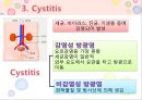 비뇨기계 질환과 간호 (신장 결석, 요관결석, 요로감염, 신장암, 방광염, 방광암, 과민성 방광, 요실금, 방광 결석, 방광요관역류, 전립선 비대증, 전립선염, 전립선 암, 음낭 질환, 고환암, 요도 협착).pptx 32페이지