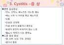 비뇨기계 질환과 간호 (신장 결석, 요관결석, 요로감염, 신장암, 방광염, 방광암, 과민성 방광, 요실금, 방광 결석, 방광요관역류, 전립선 비대증, 전립선염, 전립선 암, 음낭 질환, 고환암, 요도 협착).pptx 35페이지