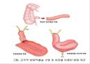 비뇨기계 질환과 간호 (신장 결석, 요관결석, 요로감염, 신장암, 방광염, 방광암, 과민성 방광, 요실금, 방광 결석, 방광요관역류, 전립선 비대증, 전립선염, 전립선 암, 음낭 질환, 고환암, 요도 협착).pptx 45페이지