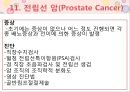 비뇨기계 질환과 간호 (신장 결석, 요관결석, 요로감염, 신장암, 방광염, 방광암, 과민성 방광, 요실금, 방광 결석, 방광요관역류, 전립선 비대증, 전립선염, 전립선 암, 음낭 질환, 고환암, 요도 협착).pptx 81페이지