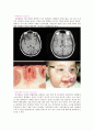 Brain _ tumor 3페이지