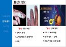 삼성반도체 불산 누출사고 ppt자료 7페이지