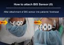 bispectral index 9페이지
