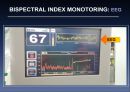 bispectral index 15페이지