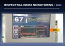 bispectral index 18페이지