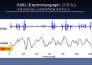 bispectral index 19페이지