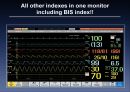 bispectral index 20페이지