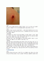 (인간과 동물 레포트) 인수공통감염병과 야생 동물 5페이지