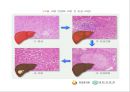 간염 (Hepatitis) (HAV, HBV, HCV, HDV, B형 간염에 쓰이는 약제, virus에 노출되는 것을 피하는 방법).pptx 15페이지