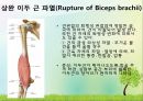 OS 진단명,정형외과 컨퍼런스 9페이지