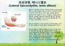 OS 진단명,정형외과 컨퍼런스 14페이지