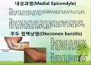 OS 진단명,정형외과 컨퍼런스 15페이지