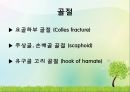 OS 진단명,정형외과 컨퍼런스 17페이지
