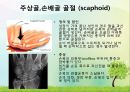OS 진단명,정형외과 컨퍼런스 19페이지
