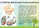 OS 진단명,정형외과 컨퍼런스 22페이지