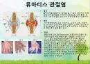 OS 진단명,정형외과 컨퍼런스 32페이지