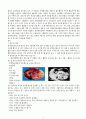  부신 낭종 (Adrenal mass) 케이스 스터디 2페이지