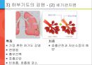 [아동간호학] 유아의 발달단계와 주요 질병 37페이지