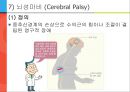[아동간호학] 유아의 발달단계와 주요 질병 43페이지