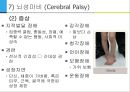 [아동간호학] 유아의 발달단계와 주요 질병 44페이지