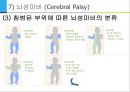 [아동간호학] 유아의 발달단계와 주요 질병 45페이지