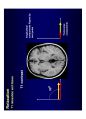 방사선사 MRI 국가고시 2차 정리집 88페이지