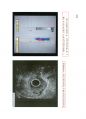 방사선사 국가고시 2차 초음파영상학 정리 22페이지