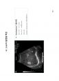 방사선사 국가고시 2차 초음파영상학 정리 81페이지