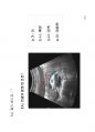 방사선사 국가고시 2차 초음파영상학 정리 97페이지