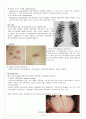 AIDS 후천성면역결핍증후군 자료수집, 발표자료, 내용요약, 5페이지