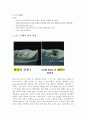 기계재료 - 인체에 무해한 의료용 티타늄 implant, 치아를 금으로 씌우는 것(골드 인레이)이 비효율적인 이유 7페이지