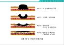 암의 종류와 영영요법 및 관리법 [암종류와 영영요법] {암의 종류에 따른 특징 및 관리법, 암의 예방, 영양소와 식품이 암에 미치는 영향 암을 이기는 영양요법}.ppt 5페이지