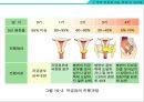 암의 종류와 영영요법 및 관리법 [암종류와 영영요법] {암의 종류에 따른 특징 및 관리법, 암의 예방, 영양소와 식품이 암에 미치는 영향 암을 이기는 영양요법}.ppt 11페이지