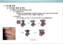 피부皮膚의 생리&유형(문제성피부)에 대한 이해 및 관리  (피부의 유형) 23페이지