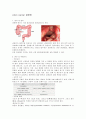 colon cancer 결장암  1페이지