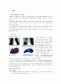 폐암 lung cancer 문헌고찰, 간호과정 예시  3페이지