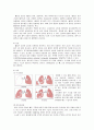 폐암 lung cancer 문헌고찰, 간호과정 예시  5페이지