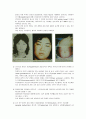 Cushing`s Syndrome 쿠싱 증후군 문헌고찰, 간호 3페이지